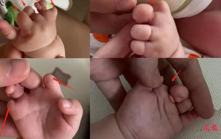 胎儿体重周期对照表 胎儿体重估计大全